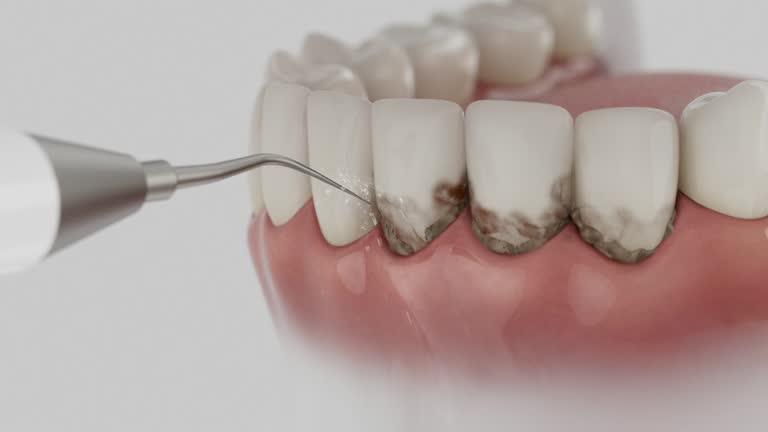 Reliable Wisdom Tooth Removal contractor in Macon County County, AL by Dentist Open Now